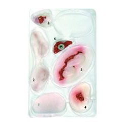 Assortiment Blessures No1 LAERDAL