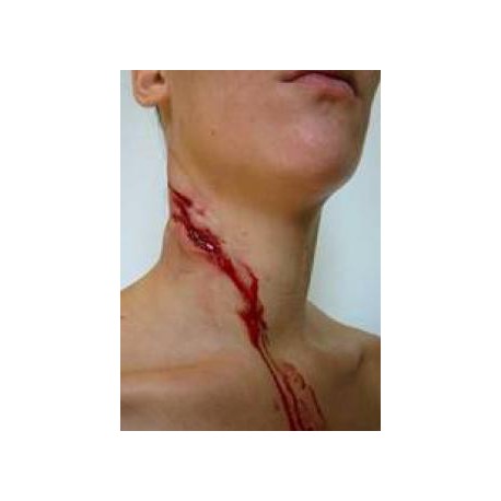 Plaie hémoragique Plaie hémoragique